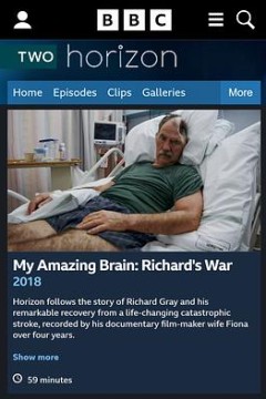 地平线系列：我的神奇大脑